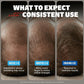 Kirkland Minoxidil 5% Hair Regrowth Solution for Men, 6-Month Supply