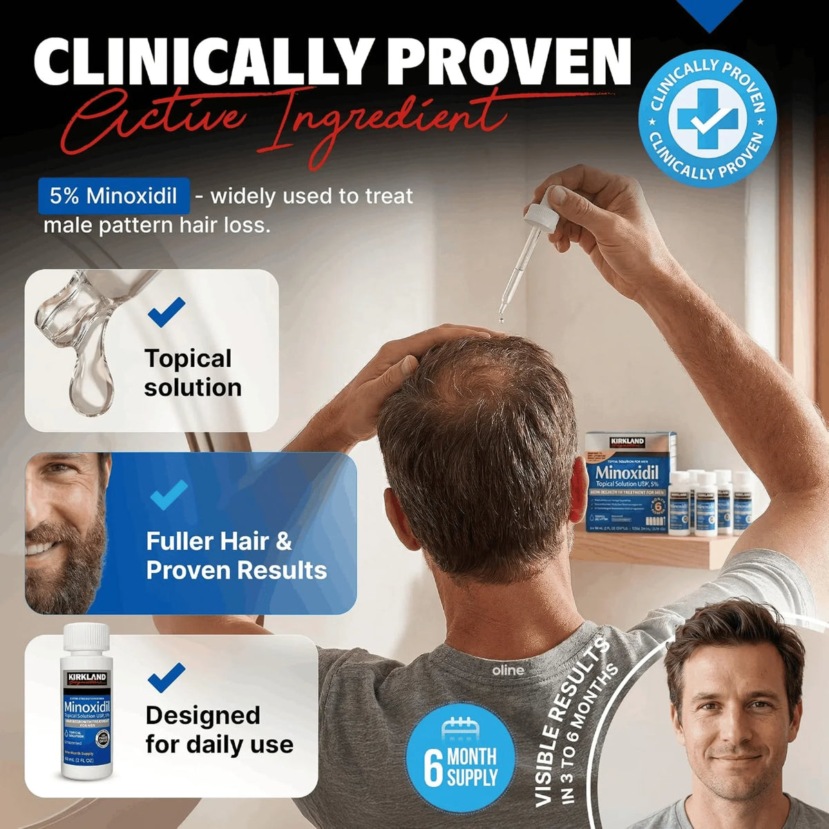 Kirkland Minoxidil 5% Hair Regrowth Solution for Men, 6-Month Supply