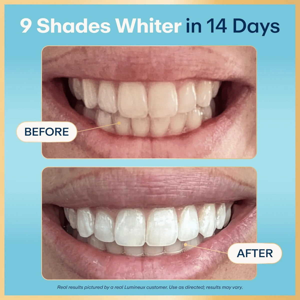 Lumineux Teeth Whitening Strips, Peroxide-Free, 21 Treatments